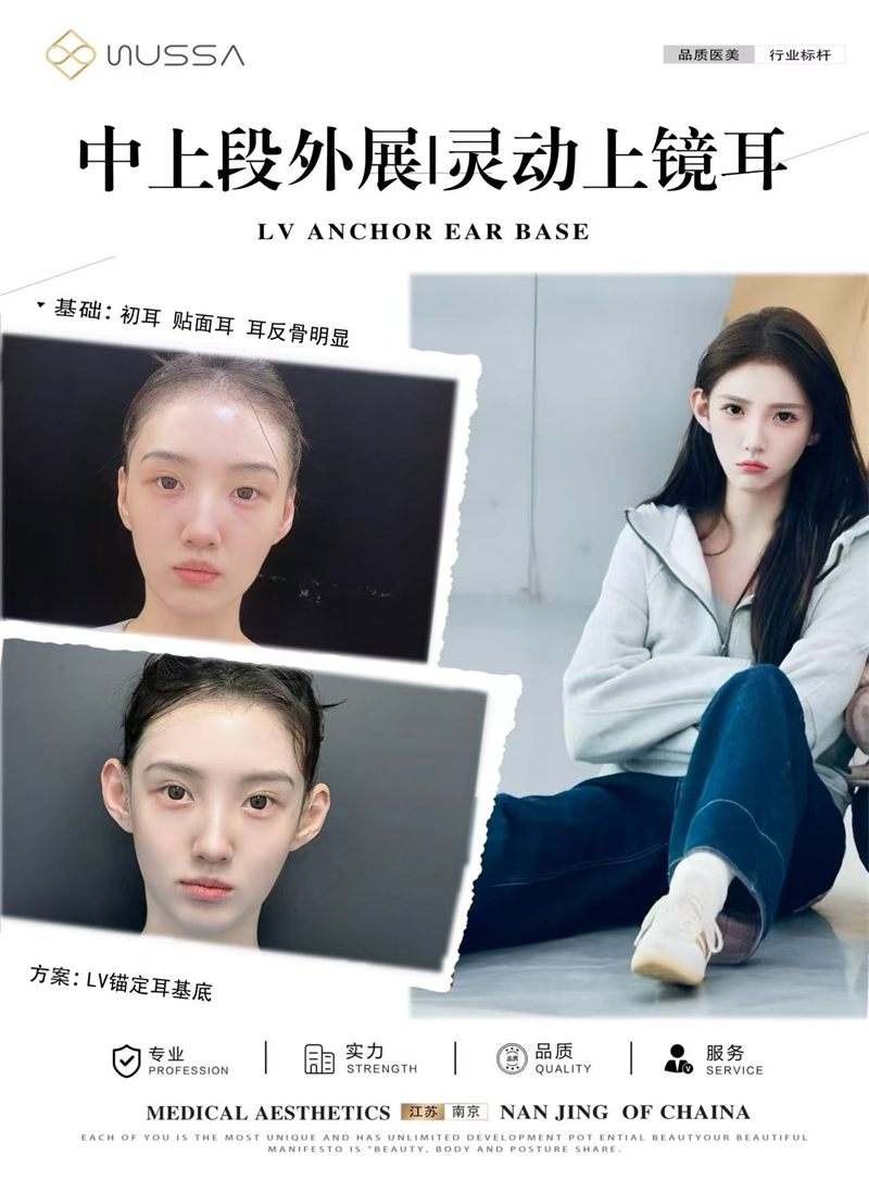 耳基底提升案例七